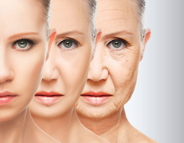 woman with wrinles removed after anti aging treatment